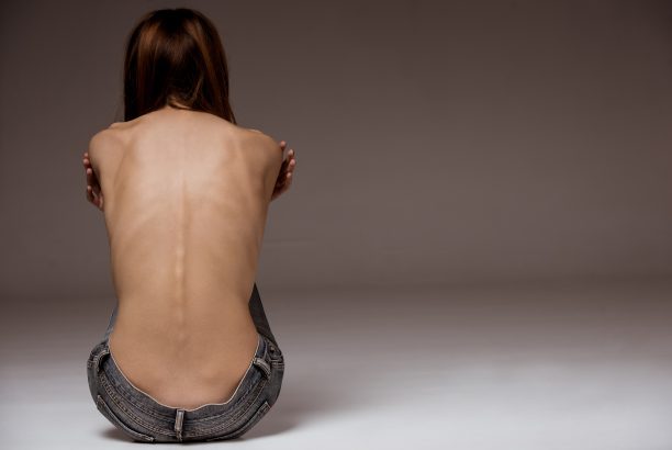 End Food Addiction at Our Food Rehab Centers